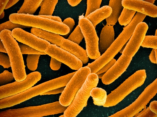 Scanning electron micrograph of Escherichia coli 